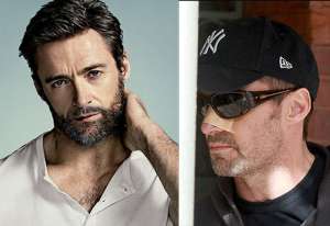 Hugh Jackman fue operado de c&aacute;ncer de piel por tercera vez
