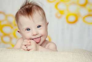 Canad&aacute; sigue en el debate de eutanasia en reci&eacute;n nacidos con s&iacute;ndrome de down.