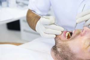 Los pat&oacute;genos en la boca inducen c&aacute;ncer oral, seg&uacute;n un estudio