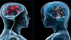 &iquest;El hombre tiene un cerebro m&aacute;s grande que la mujer?