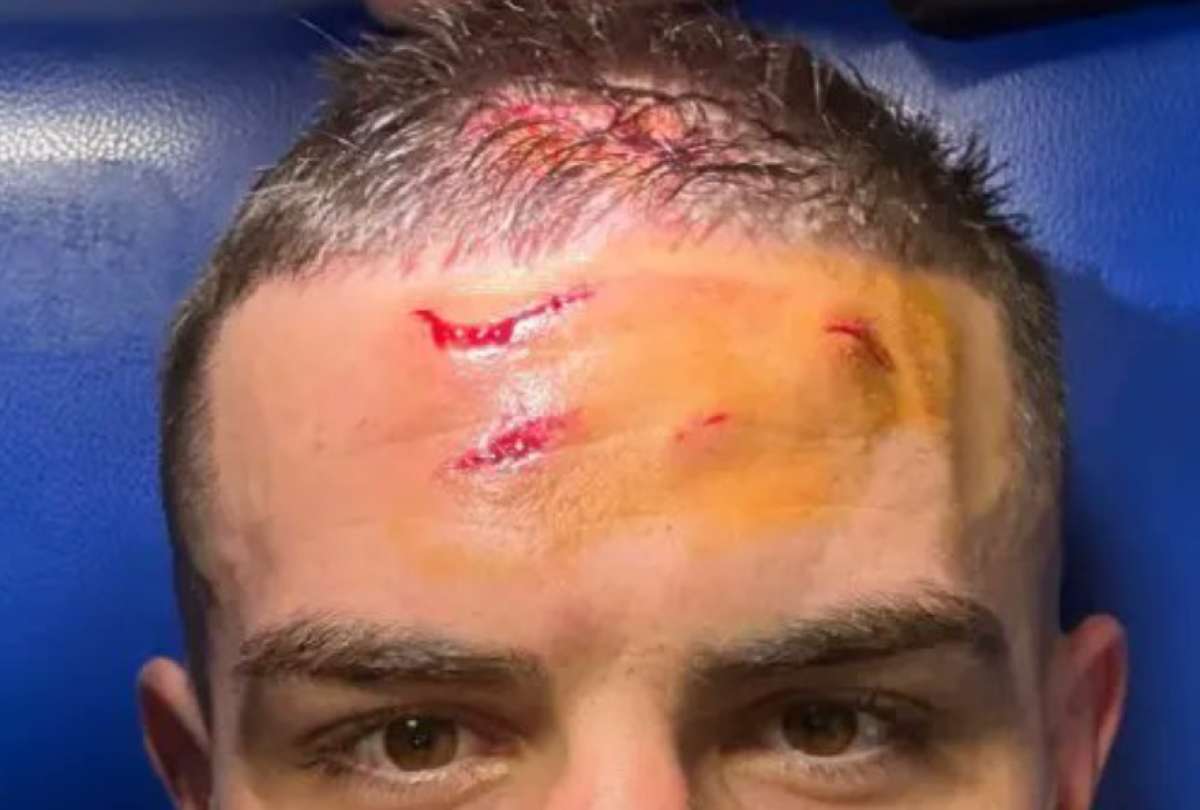 Nikola Krstovic termin&oacute; herido y Atalanta clasific&oacute;