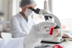 En Ecuador, existen aproximadamente 835 personas con trastornos hereditarios de la coagulaci&oacute;n.