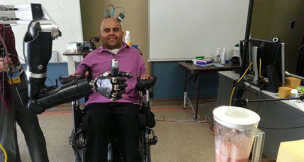 Erik Sorto, de 34 a&ntilde;os, es la primera persona en el mundo que tiene una pr&oacute;tesis neural implantada en una regi&oacute;n del cerebro donde se generan las intenciones. FOTO: Internet 