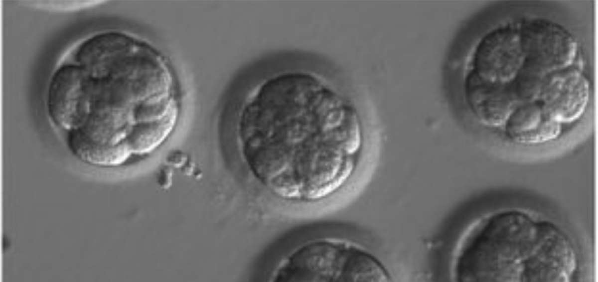 Esta investigaci&oacute;n, que se encuentra en fase preliminar, abre potencialmente la v&iacute;a a grandes avances en el tratamiento de las enfermedades gen&eacute;ticas.