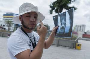&Aacute;lex M&eacute;ndez muestra las lesiones en su rostro. Foto: Miguel Jim&eacute;nez / El Tel&eacute;grafo 