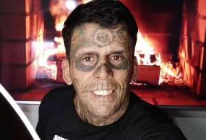 Leandro de Souza, el hombre más tatuado de Brasil se quitó los tatuajes de su rostro y cuerpo.