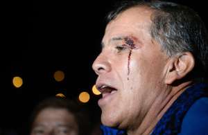 Paco Velasco, militante de Alianza PAIS, result&oacute; herido. Foto: &Aacute;lvaro P&eacute;rez / El Tel&eacute;grafo
