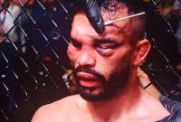 El rostro de Rob Font quedó afectado por la superioridad del Chito Vera