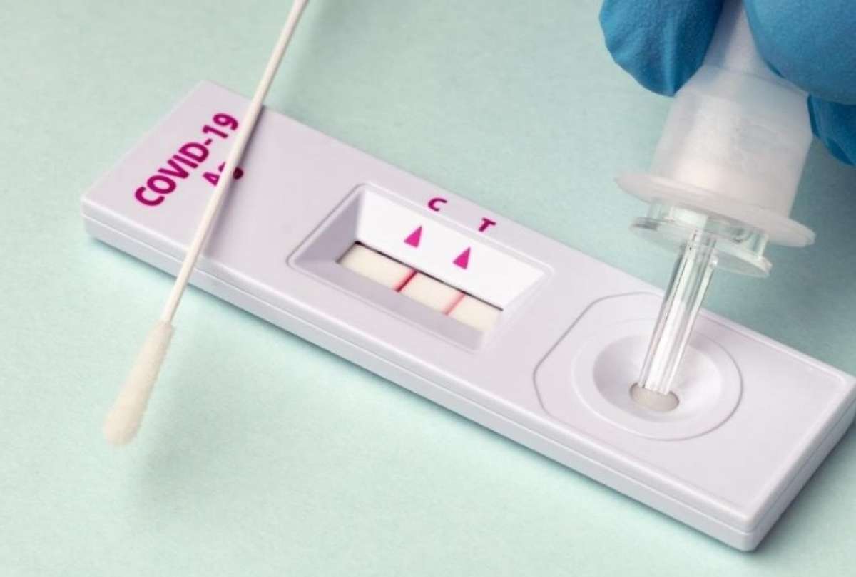 Mecanismo en Ecuador permitirá liberar pruebas de antígenos caseras de forma digital.