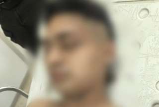 Presunto extorsionador perdió su mano al detonar un explosivo