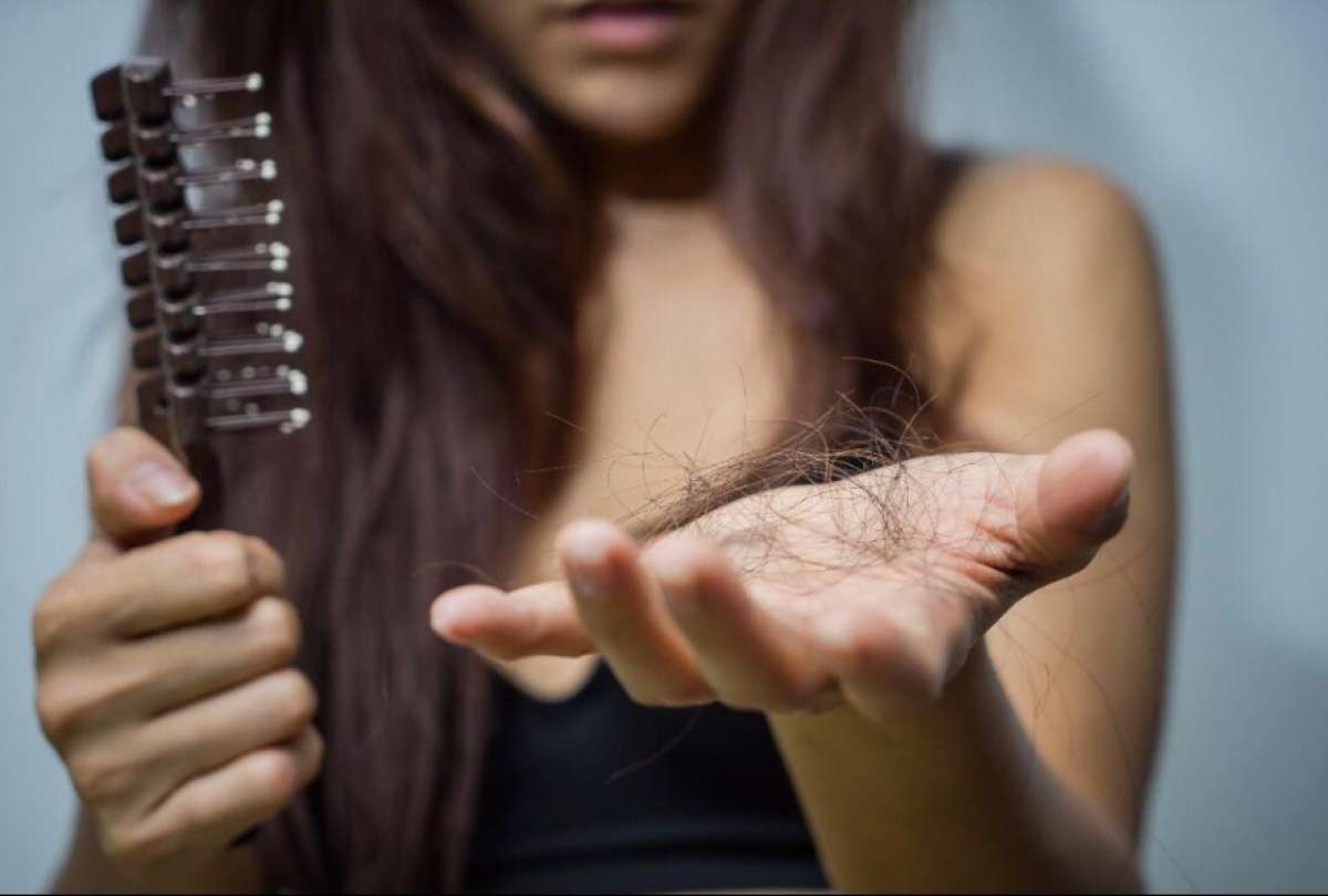 Tips para evitar la ca&iacute;da del cabello tras contagiarse del covid-19