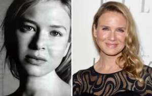 Cambio de aspecto de Ren&eacute;e Zellweger habr&iacute;a sido por operaci&oacute;n de mejillas y nariz