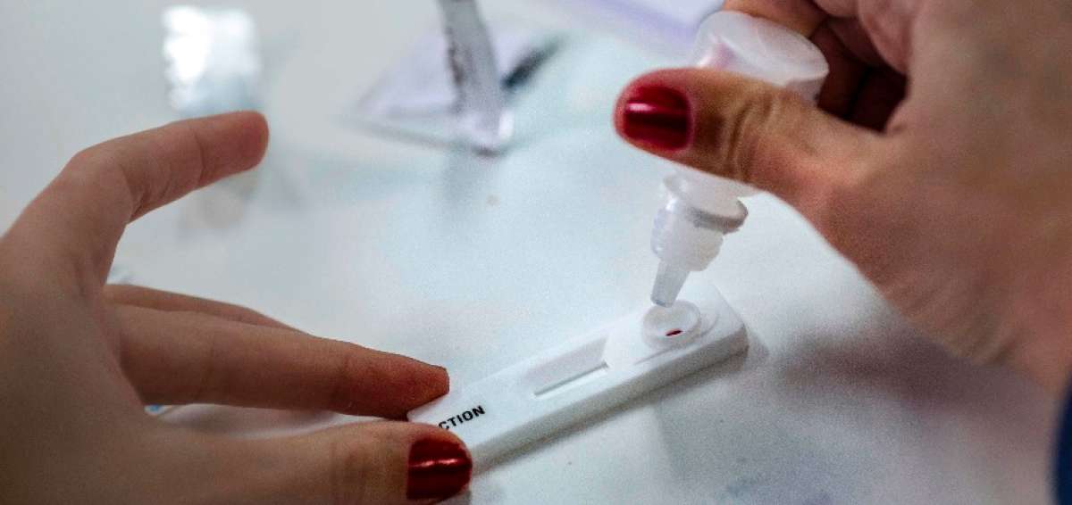 Farmacias de Brasil comienzan a vender "auto-test" del sida