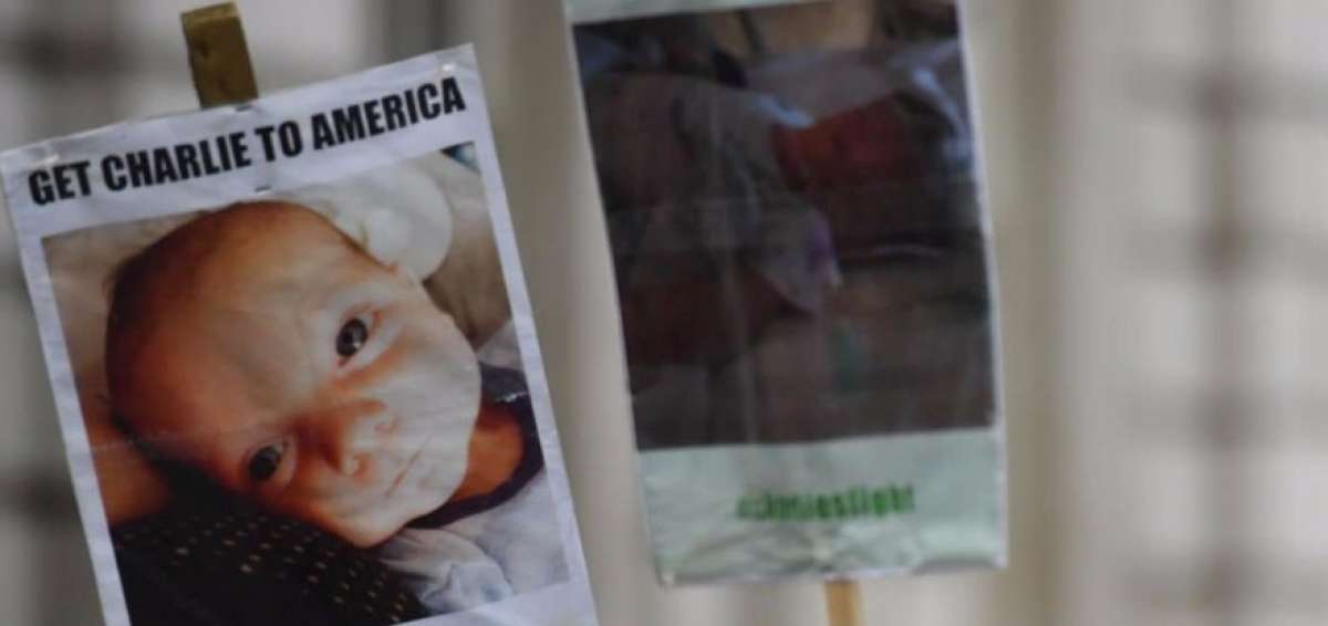 Los padres del beb&eacute; de 10 meses luchan para que su hijo pueda recibir tratamiento en Estados Unidos.