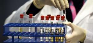Para manipular las pruebas antidoping, los rusos a&ntilde;ad&iacute;an Nescaf&eacute; y sal a las muestras de orina, entre otros trucos, denunci&oacute; el investigador.