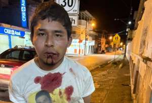 Polic&iacute;a detiene a sujeto que habr&iacute;a usado la identidad de su hermano para delinquir