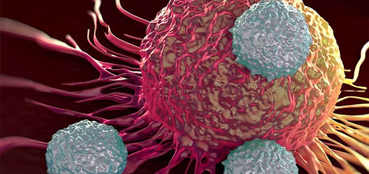 Los c&aacute;nceres de test&iacute;culos, p&aacute;ncreas y lengua hacen met&aacute;stasis con rapidez