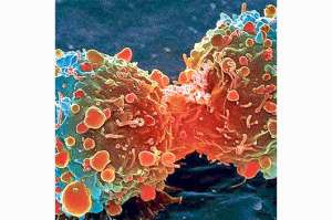 Nueva investigaci&oacute;n asegura que el c&aacute;ncer obedece a &lsquo;la mala suerte&rsquo;