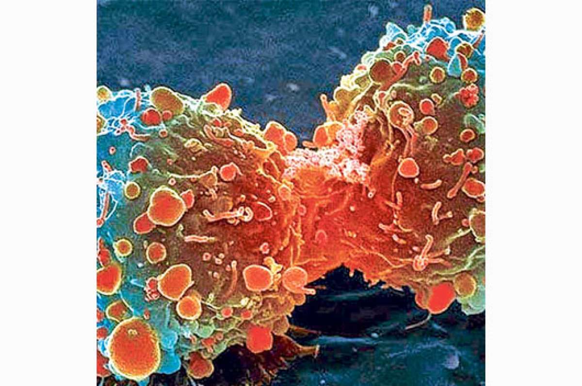 Nueva investigaci&oacute;n asegura que el c&aacute;ncer obedece a &lsquo;la mala suerte&rsquo;
