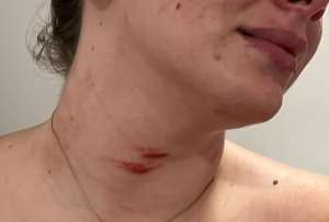 Javier Andrés Celi, dirigente político de la RC5 fue denunciado por su pareja Nicolle Aray de intento de femicidio.