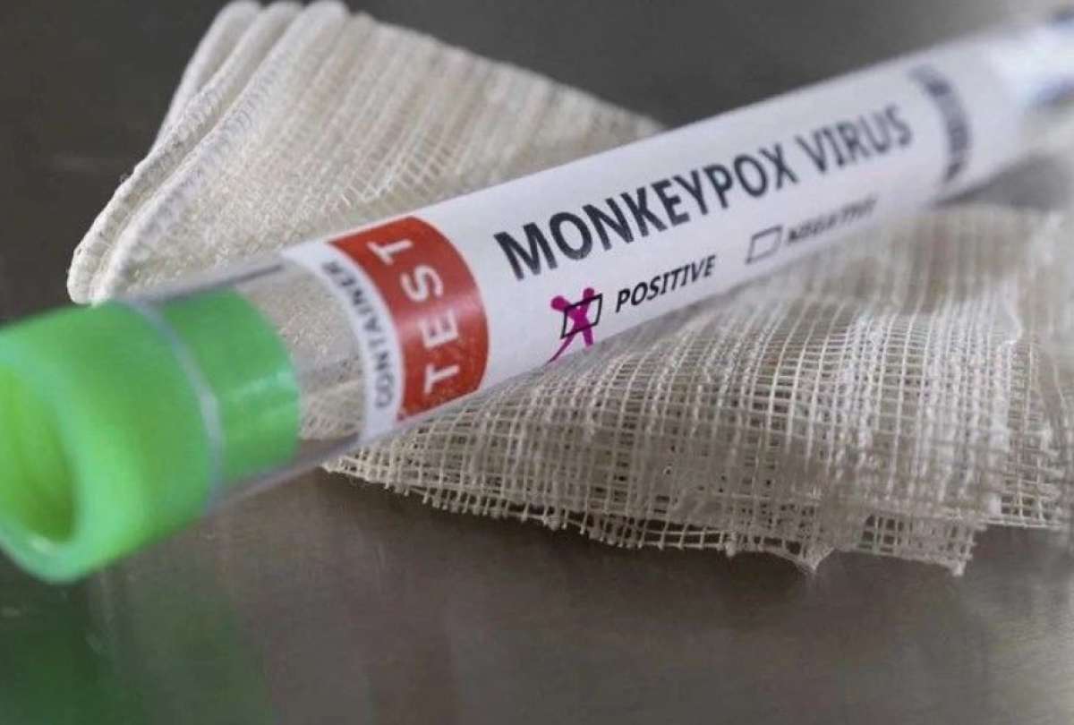 Corea del Sur y Singapur han reportado sus primeros casos de la viruela del mono