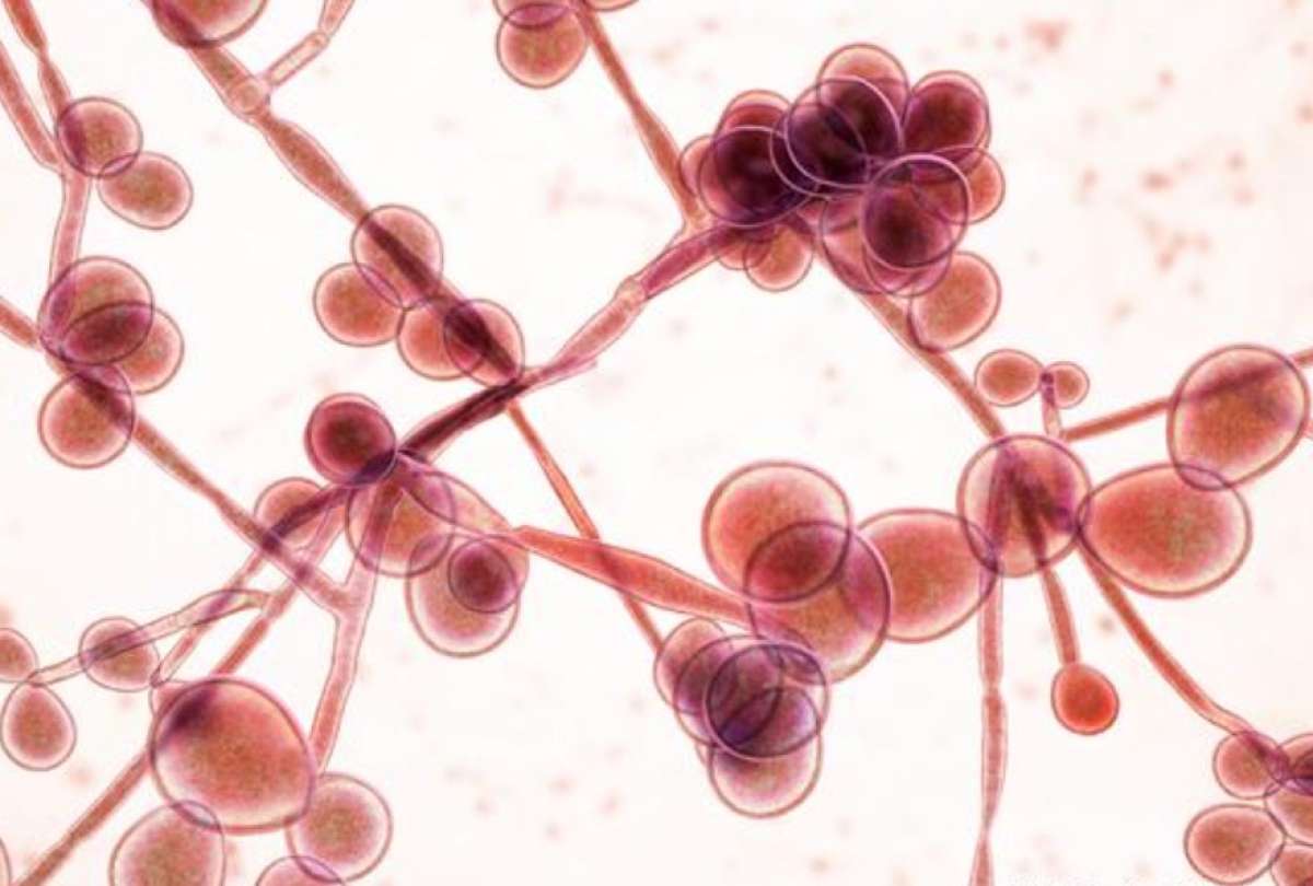 Brasil registra su primer posible caso de raro y potencialmente fatal hongo "Candida auris"