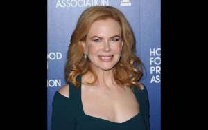 Nicole Kidman se arrepiente del botox