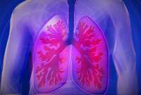 Vacuna terapéutica contra el cáncer de pulmón se abre paso en Estados Unidos