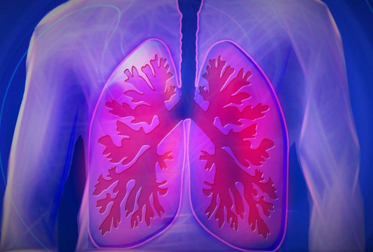 Vacuna terapéutica contra el cáncer de pulmón se abre paso en Estados Unidos