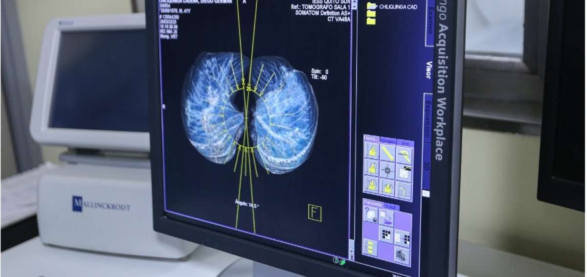 Contagios por coronavirus en Ecuador subieron en 38 casos