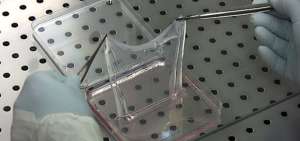  Los expertos utilizaron c&eacute;lulas corregidas para cultivar piel en el laboratorio.
