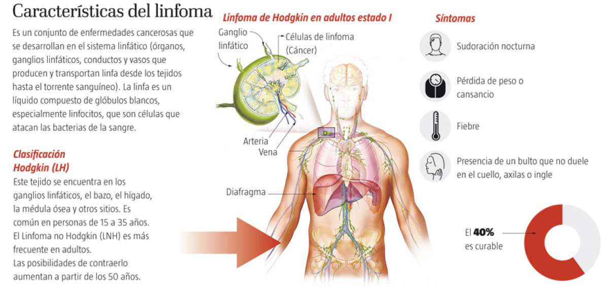 Quito concentra los casos de linfoma
