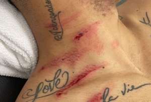 Matheus Cunha mandó un mensaje luego de las huellas que le dejó Domínguez en su cuello
