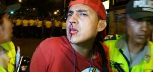 Fot&oacute;grafo es agredido por simpatizantes de CREO en Guayaquil