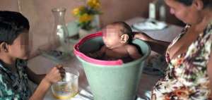 Pedir&aacute;n a corte suprema de Brasil que autorice abortos en casos de microcefalia