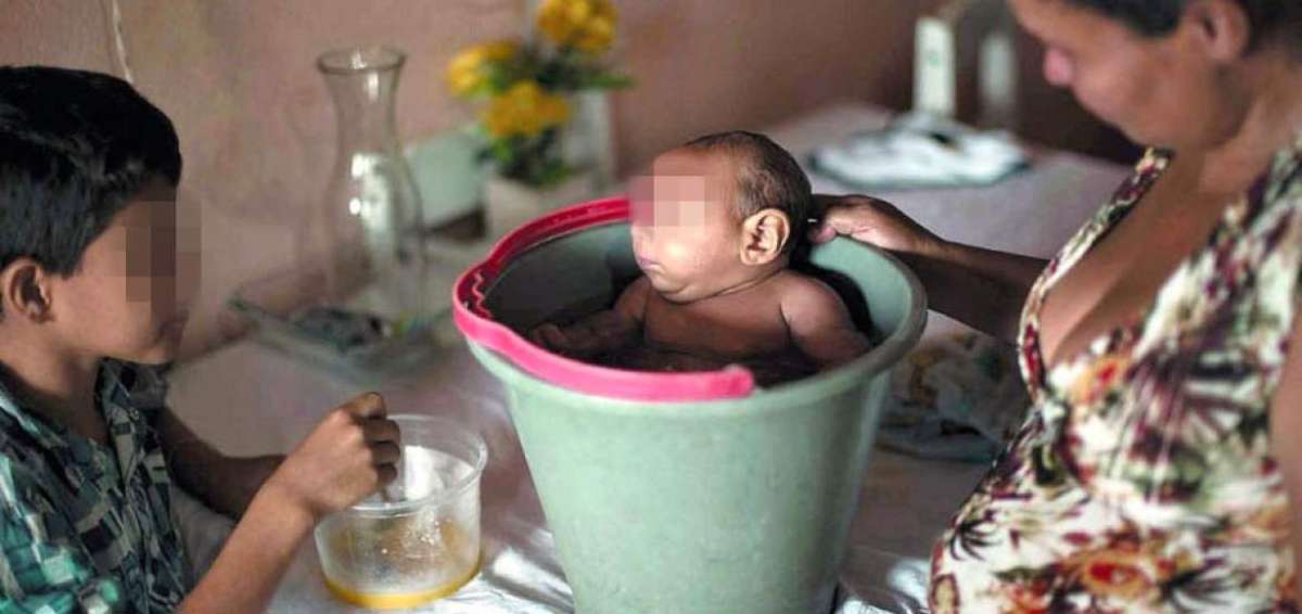Pedir&aacute;n a corte suprema de Brasil que autorice abortos en casos de microcefalia