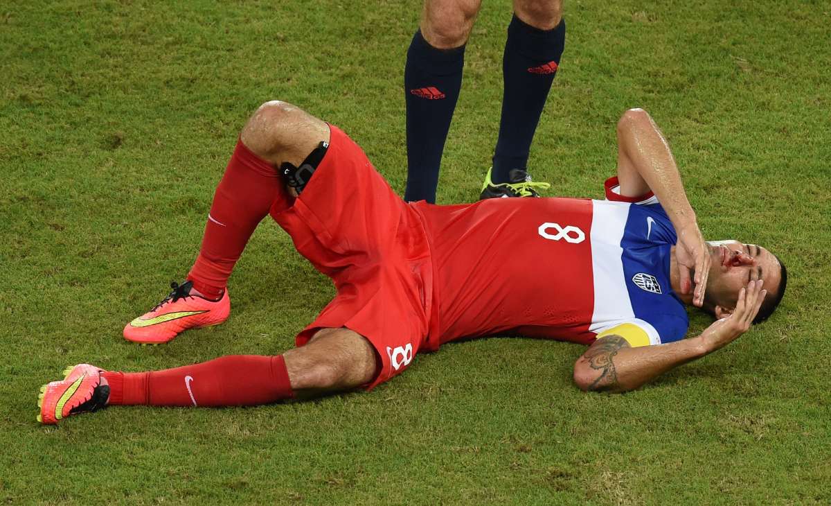 Clint Dempsey se fractur&oacute; la nariz en el encuentro de ayer ante Ghana. Foto: AFP
