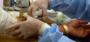 Estudio advierte las dificultades para eliminar la tuberculosis y el VIH en el mundo