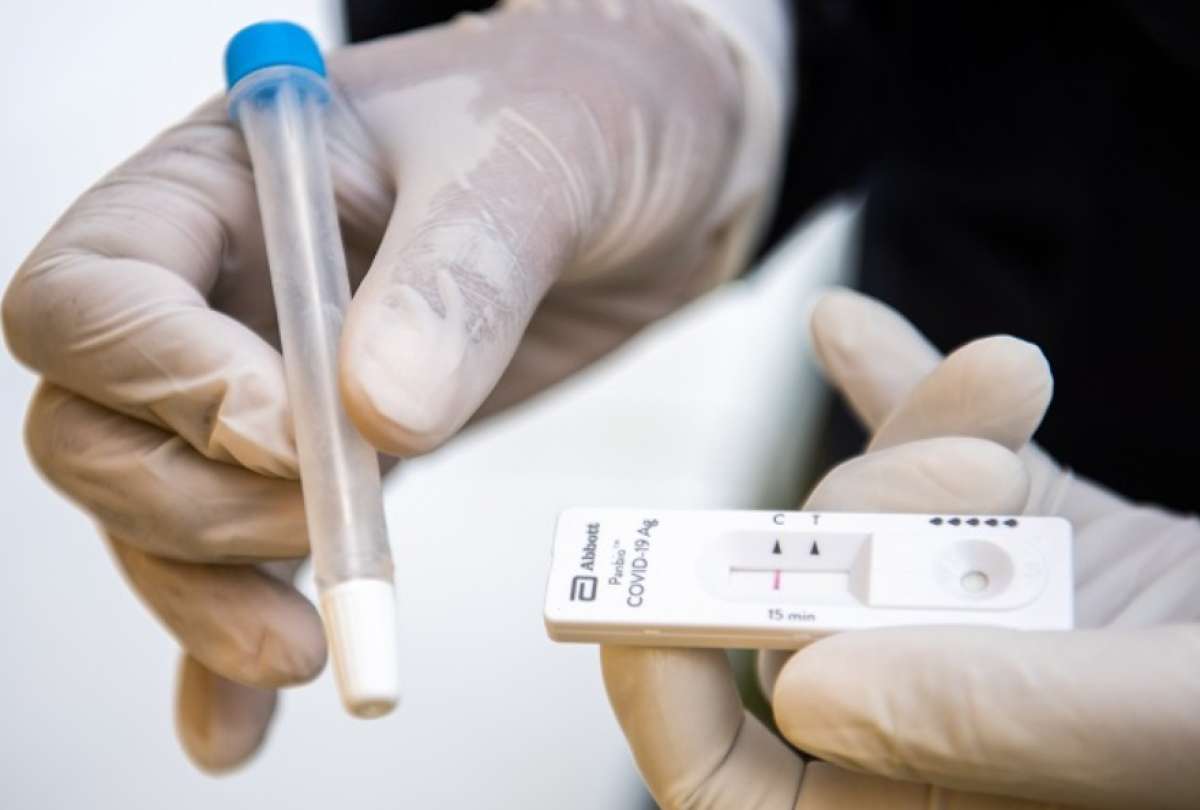 Aprueban autotest para detectar gripe y covid-19 a la vez