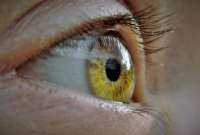 Joven se provoca una infección en los ojos por someterse a un procedimiento en las pestañas