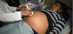 En Brasil se reporta un aumento de abortos, ante el temor de que el feto desarrolle microcefalia por el virus zika. Una operaci&oacute;n de este tipo cuesta hasta $ 4.000. 