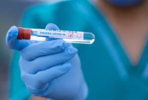Modelo matemático revela subregistro de casos de covid-19 en el mundo