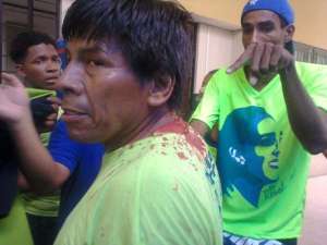 Este ciudadano present&oacute; lesiones en la cabeza que le provocaron sangrado abundante.