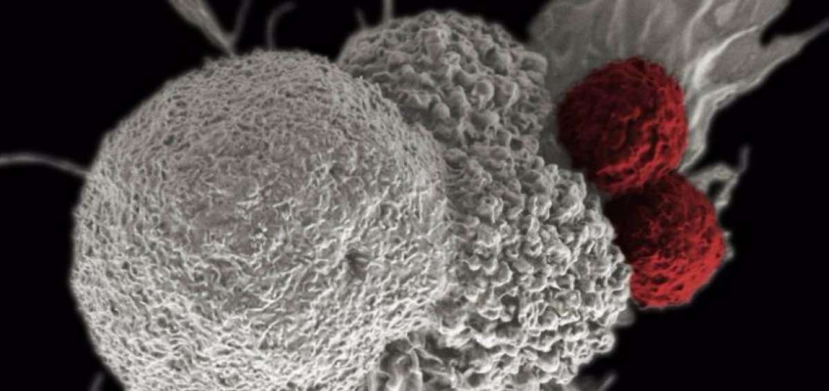 Crean cat&aacute;logo de tipos de c&aacute;ncer para personalizar los tratamientos&nbsp;