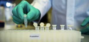 Acess publica listado de laboratorios para pruebas y toma de muestras covid-19