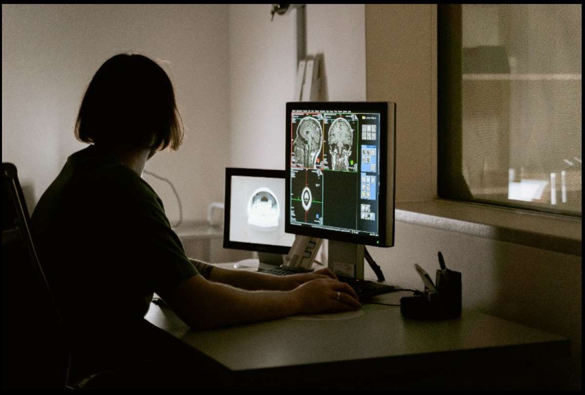 Cuales son las posibles consecuencias a largo plazo en el cerebro por el covid-19