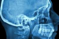 Científicos identifican nueva parte del cuerpo esencial para masticar