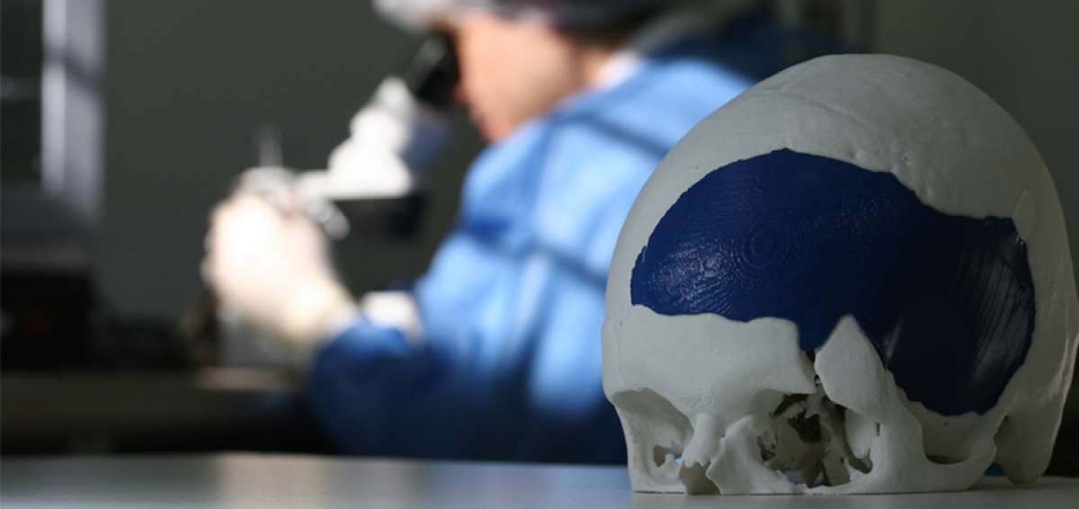 La craneoplastia 3D devuelve  la felicidad a Segundo y Nancy