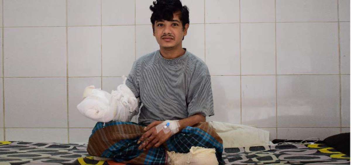 Abul Bajandar, de 27 a&ntilde;os, comenz&oacute; a desarrollar la epidermodisplasia verruciforme en la adolescencia.  