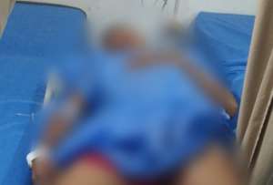 Intento de robo de motocicleta termina con un sospechoso herido, seg&uacute;n la Polic&iacute;a